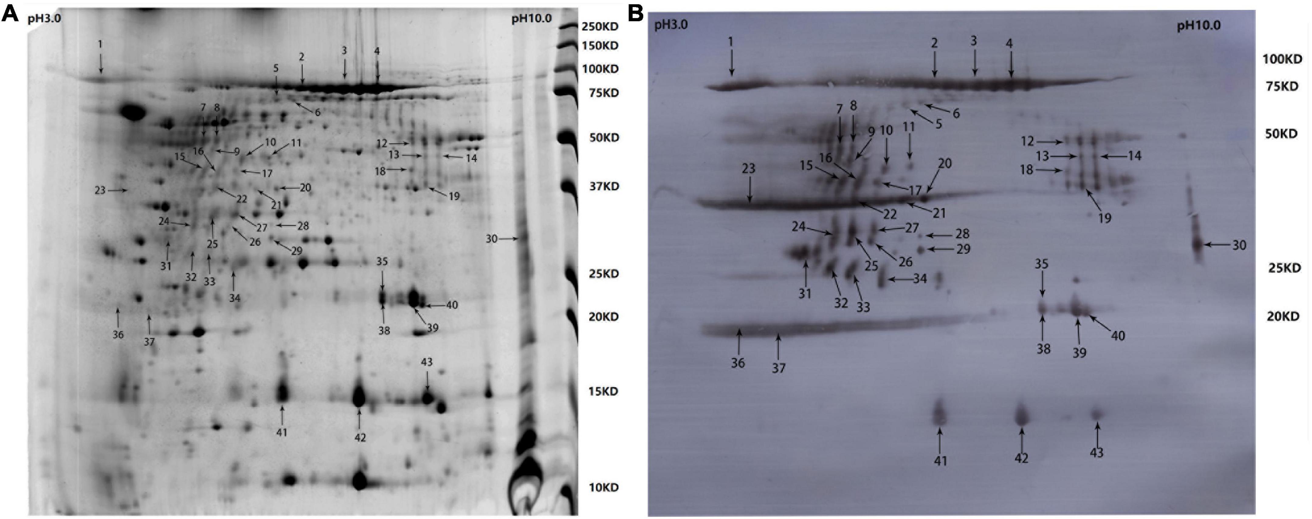 PaR1 secreted by the type IX secretion system is a protective antigen of Riemerella anatipestifer